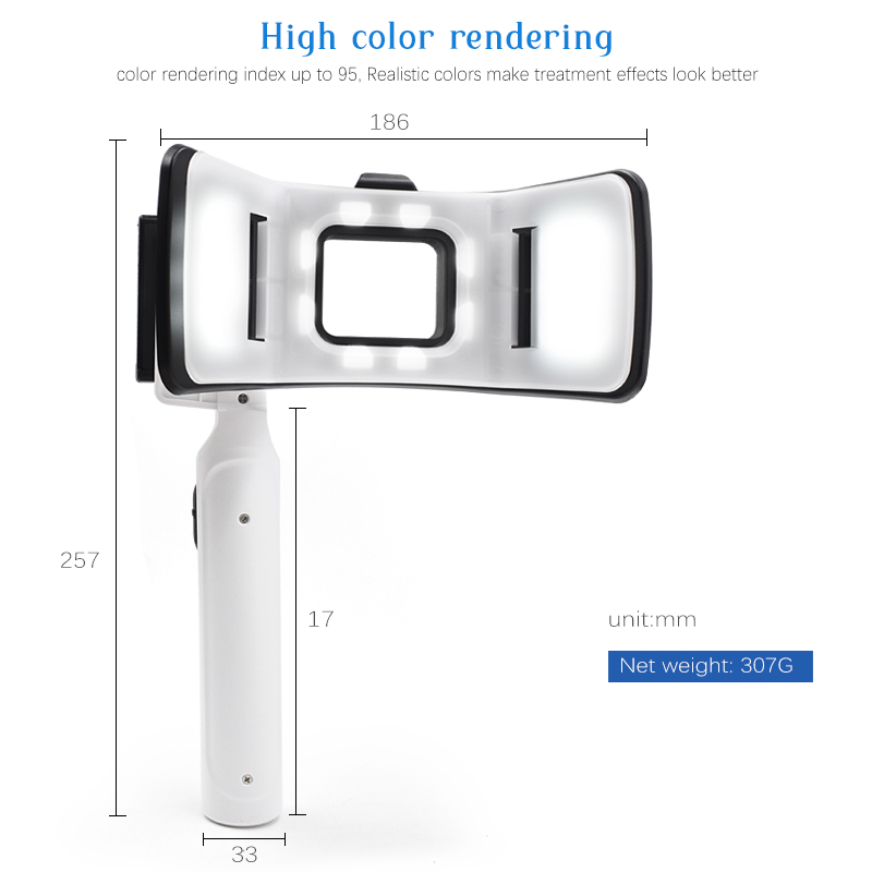 ไฟถ่ายภาพทันตกรรมแบบแฟลชคู่ระด - Photography With Mobile บทวิจารณ์และราคา